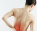 west-end-physio-vancouver-Complex-Chronic-Pain-therapy